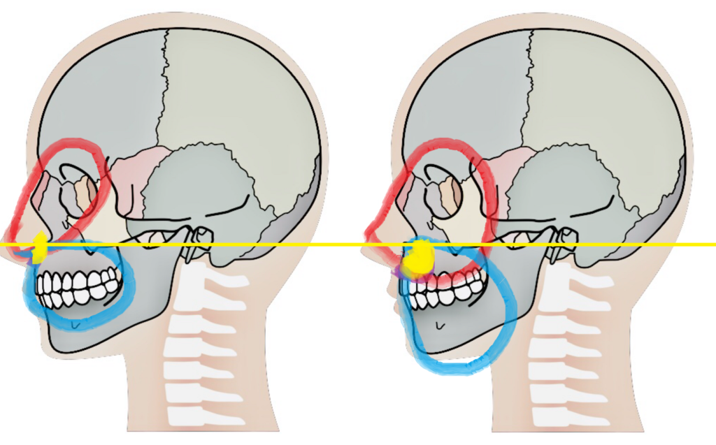皮膚が骨を動かす 肌張力正顔法